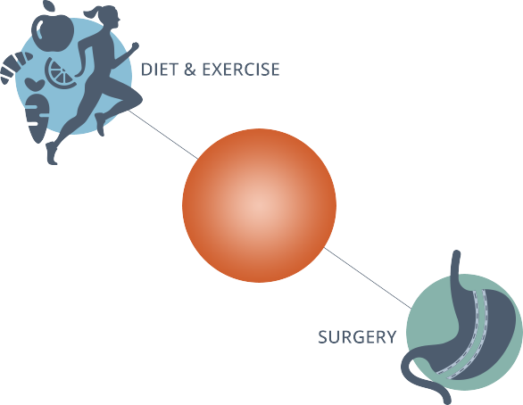 gastric-balloon-surgery